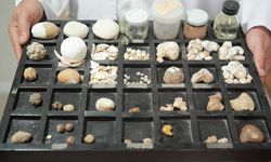 Hastaların çilesi olan ’taşlar’ üroloji uzmanına koleksiyon oldu